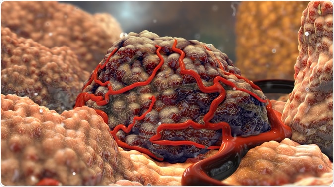 Tumor Tumor