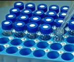 Liquid Chromatography-Mass Spectrometry (LC-MS) for Biomarker Discovery