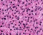 How to Best Utilize Brain and Tissue Matrices