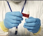 Analysis of Postmortem Microbes using Gas Chromatography