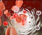 What are Electrochemical Biosensors?