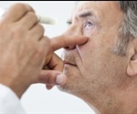 Breakthrough Discovery about Glaucoma could Lead to New Treatments