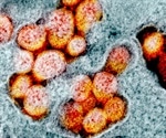 Thiopurines could help stop viral replication in human coronaviruses
