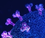 Joint Pathology Center selects Huron Digital Pathology’s image search engine to unlock vast knowledge contained in world’s largest human tissue repository