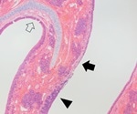 Cats and dogs are low risk for SARS-CoV-2 transmission to humans
