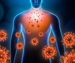What is Pneumonitis?