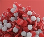 The connection between severe COVID-19 and white blood cell counts