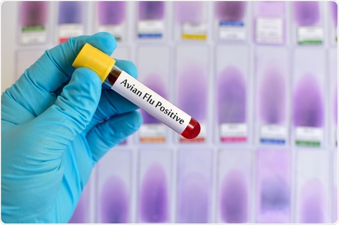 Avian Flu Test Avian Flu Test
