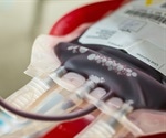 Blood purification outside the body in COVID-19 patients