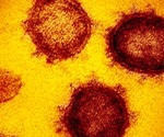 Critically ill COVID-19 patients experience novel platelet-activating immune complexes, study finds