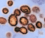 Peptide-conjugated morpholino oligomers effectively inhibit SARS-CoV-2 in vero cells