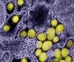 The role of micro-RNA in SARS-CoV-2 infection and COVID-19