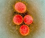 Hydrogen therapy may help severely ill COVID-19 patients