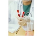 Anti-Human Secondary Antibodies and their Importance in Serological Testing