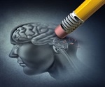 Research explores links between Alzheimer's and Parkinson′s to COVID-19