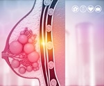 Discovering a new role for a protein that could cause breast cancer to spread to the lungs