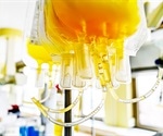 Convalescent plasma in COVID-19 can be effective, especially early in disease