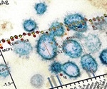 PTC299 inhibits SARS-CoV-2 replication and suppresses production of inflammatory cytokines