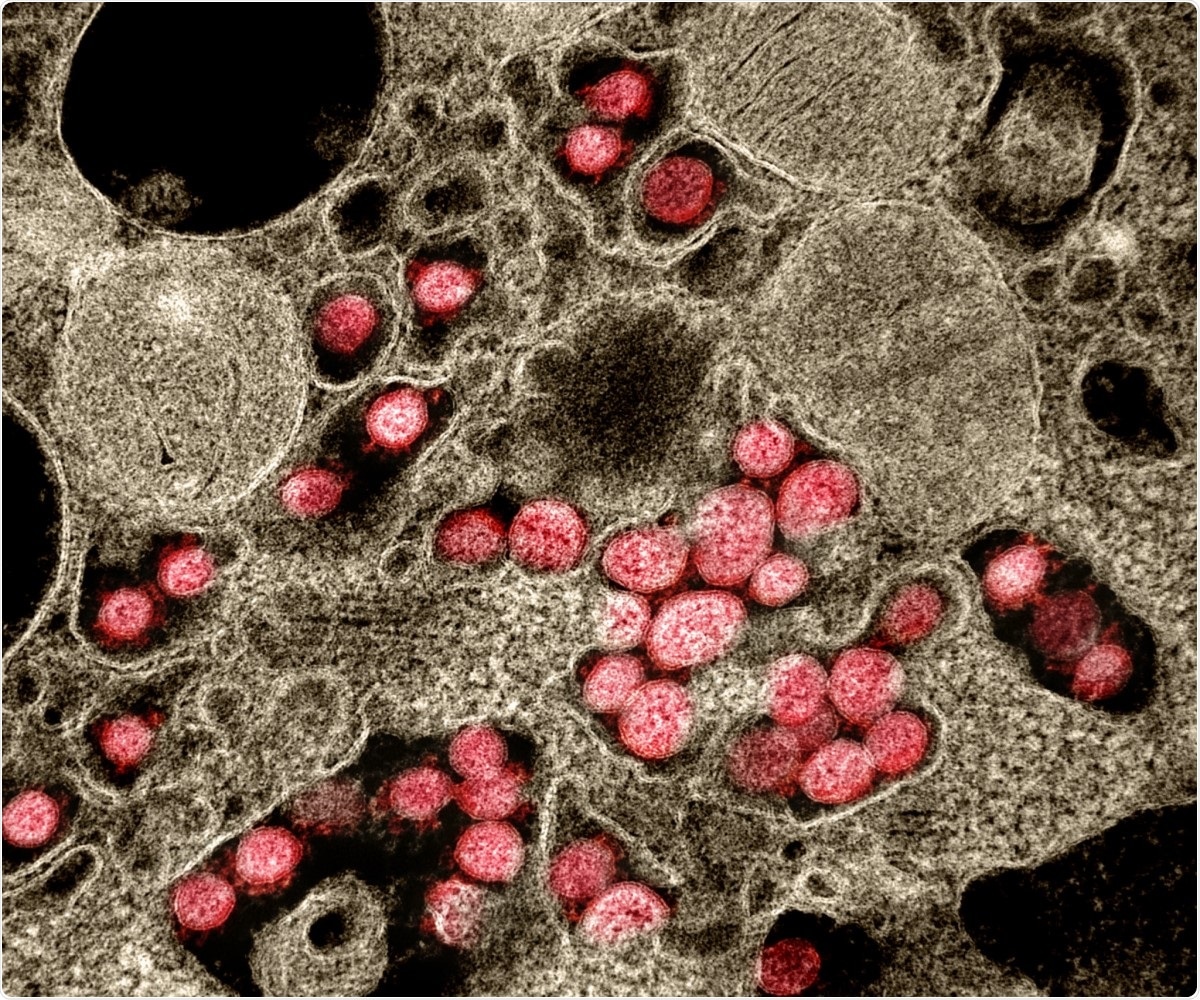 Study: Neutrophil more than platelet activation associates with thrombotic complications in COVID-19 patients. Image Credit: NIAID / Flickr