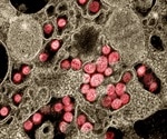 Neutrophils may play a key role in COVID-19-related thrombosis