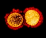 SARS-CoV-2 surface proteins alter the expression of key chemokines and cytokines in cell lines