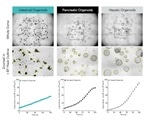 3D Organoid Growth in Matrigel® Domes: Real-Time, Live-Cell Analysis