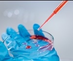 Cardiovascular Testing Applications of Biochemistry