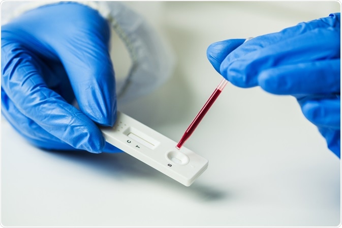 blood test