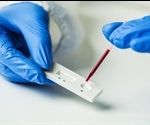 Ultra-Sensitive Detection of Iron Disorders Using Nanosensors