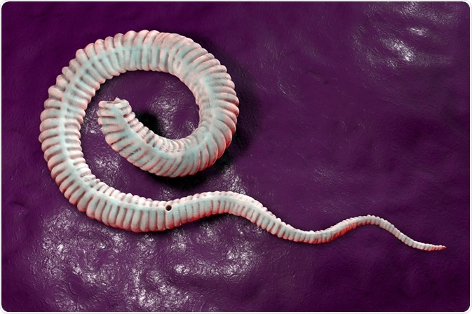 dracunculiasis
