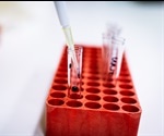 Analyzing Neuroimmune Cell Populations Using Flow Cytometry