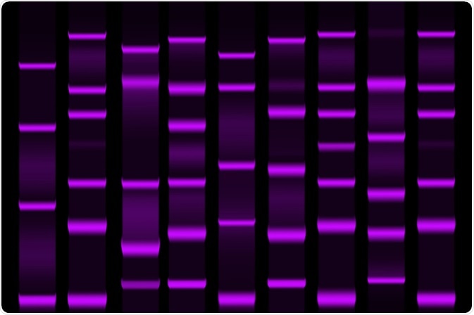 electrophoresis