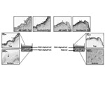 Peptide Hydrogels for Prevention of Esophageal Strictures