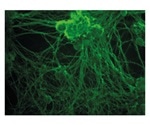 Nerve Repair by Delivering Stem Cell Therapies