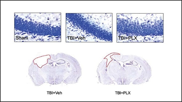 Dampening effects of overactive immune cells may serve as new treatment for TBI Dampening effects of overactive immune cells may serve as new treatment for TBI