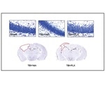 Dampening effects of overactive immune cells may serve as new treatment for TBI