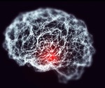 Magnetic Resonance Imaging of Noradrenergic Neurons