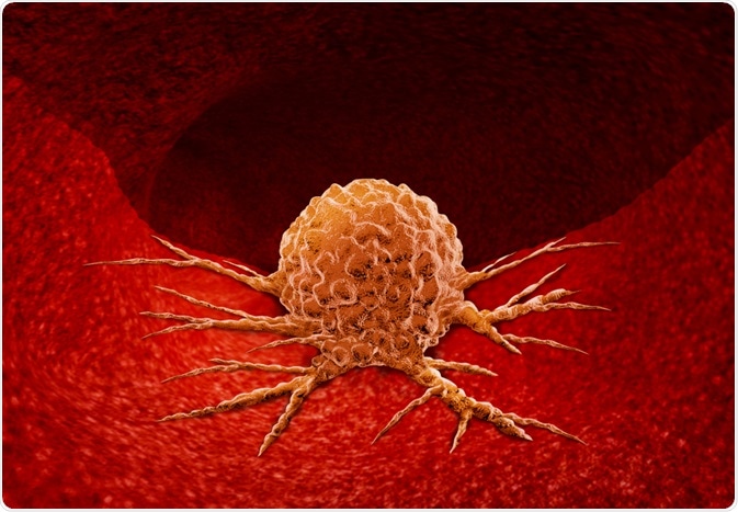 Tumor Cell Tumor Cell
