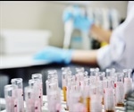 Recognizing CDKL5 Deficiency Disorder