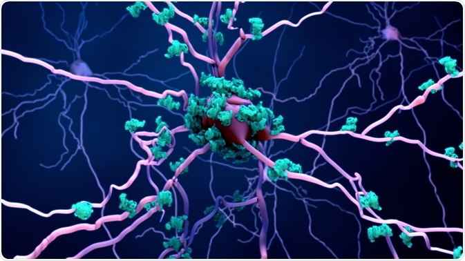 Neuron Death