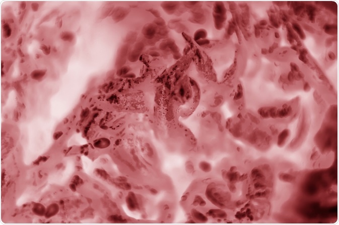 HeLa Cells HeLa Cells