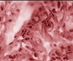 What are HeLa Cells?