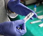 "State of the Nation" report on STIs in England released