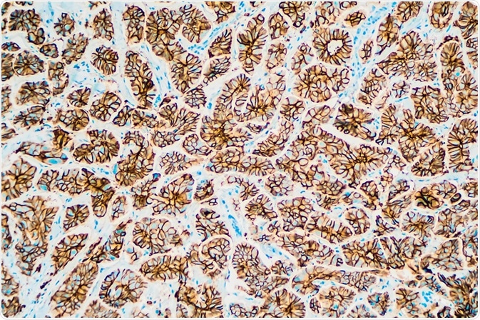 Immunohistochemistry Immunohistochemistry