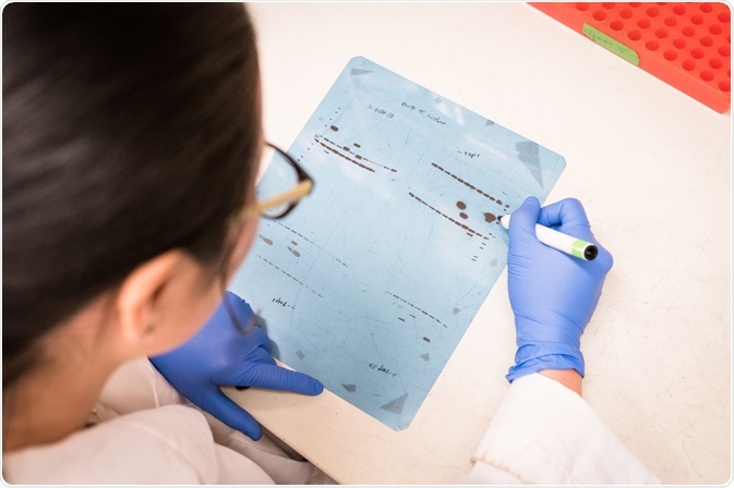 Western Blot Western Blot