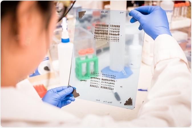 Western Blot Western Blot