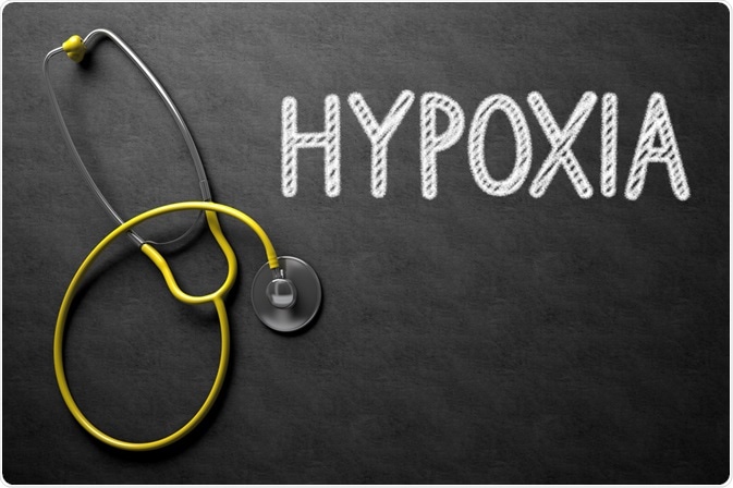 Hypoxia Hypoxia