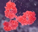 What is Common Variable Immune Deficiency (CVID)?