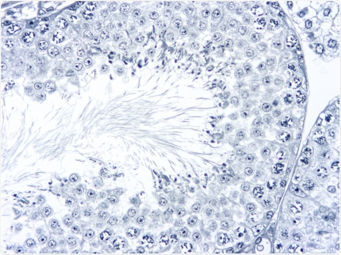 Spermatogenesis Spermatogenesis