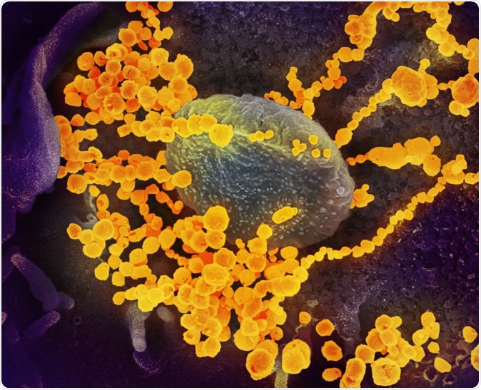 Novel Coronavirus SARS-CoV-2: This scanning electron microscope image shows SARS-CoV-2 (round gold objects) emerging from the surface of cells cultured in the lab.  Credit: NIAID-RML